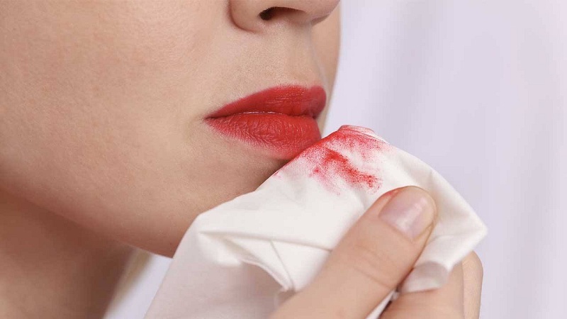 Remove the lipstick with a warm cloth