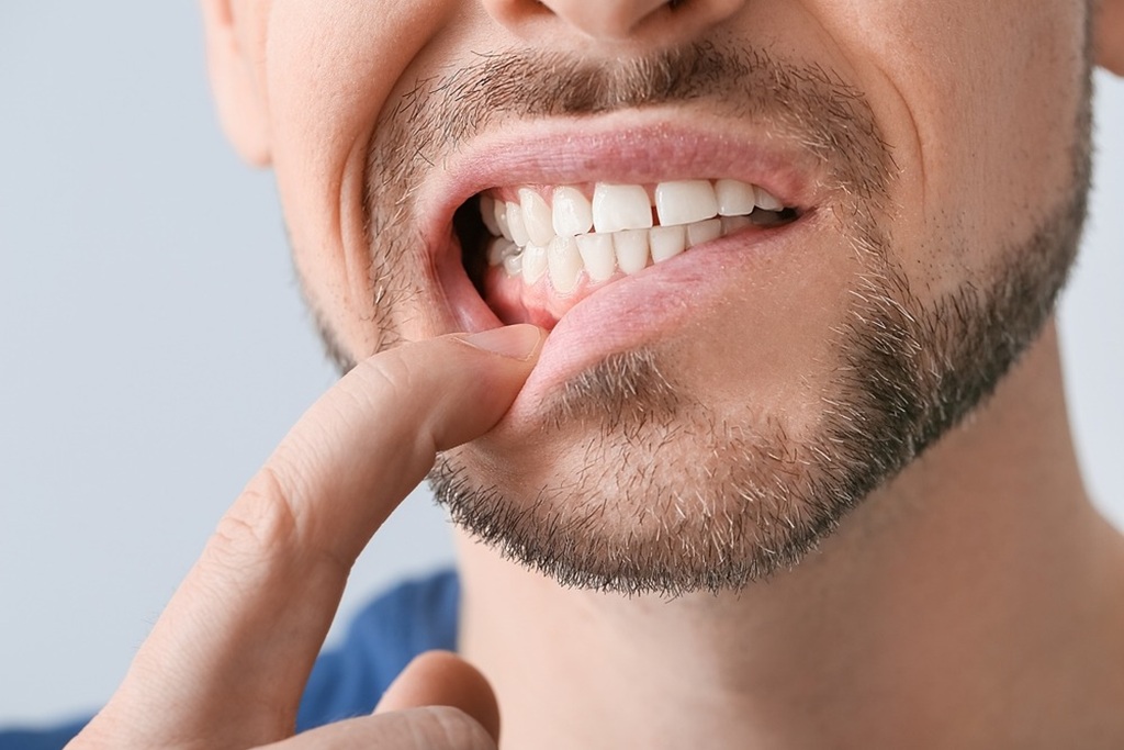 Why Does My Tooth Filling Hurt After Months - Think Different